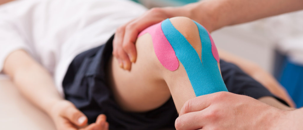 Kinesio taping in rehabilitation - Kennington Osteopaths & Physiotherapy